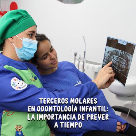 Terceros molares en odontología infantil: la importancia de prever a tiempo